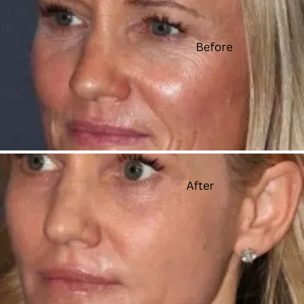Organic anti-aging skincare for glowing skin